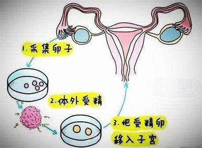 国内哪里可以借卵生子(国内哪里可以借卵生子?)